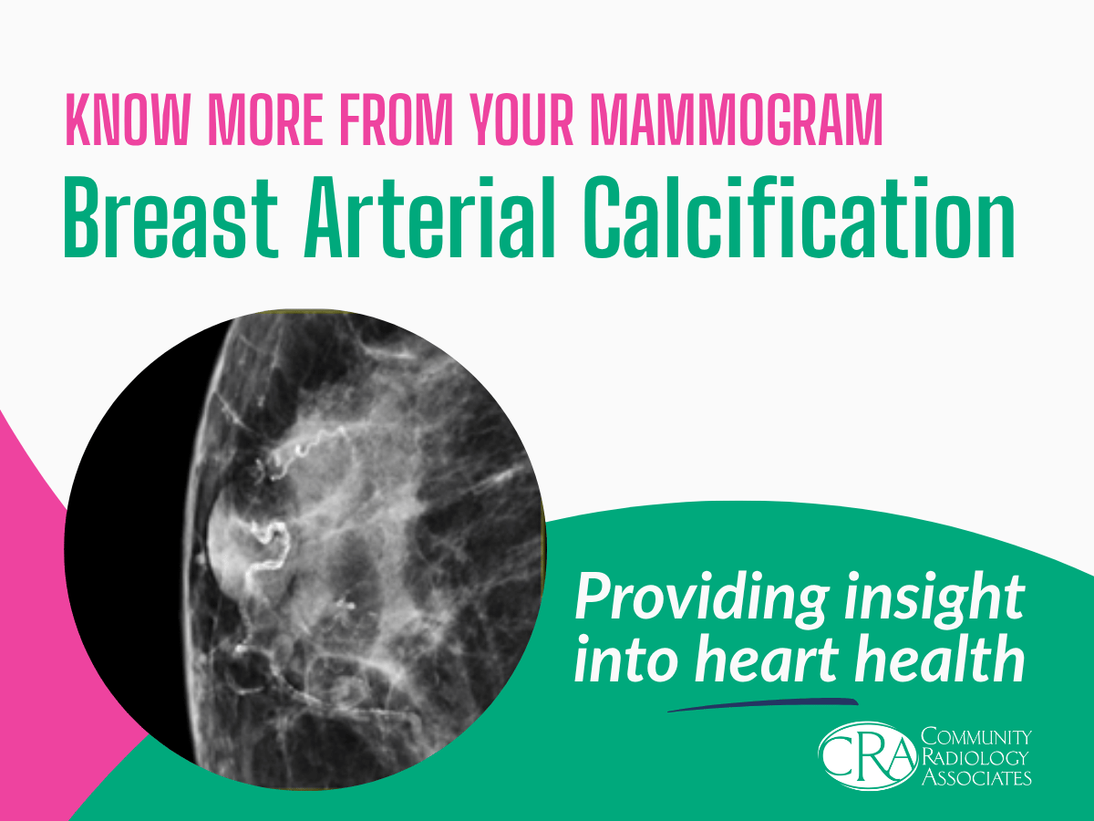 Reporting for Breast Arterial Calcifications