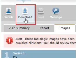 Images tab with Download button